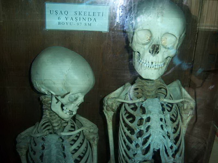 Настоящие и гипсовые кости: визит в Музей анатомии Азербайджана в 2010 г. (ФОТО)